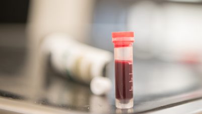 Blood samples in test tube