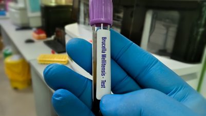 Brucella Mellitensis blood sample tube